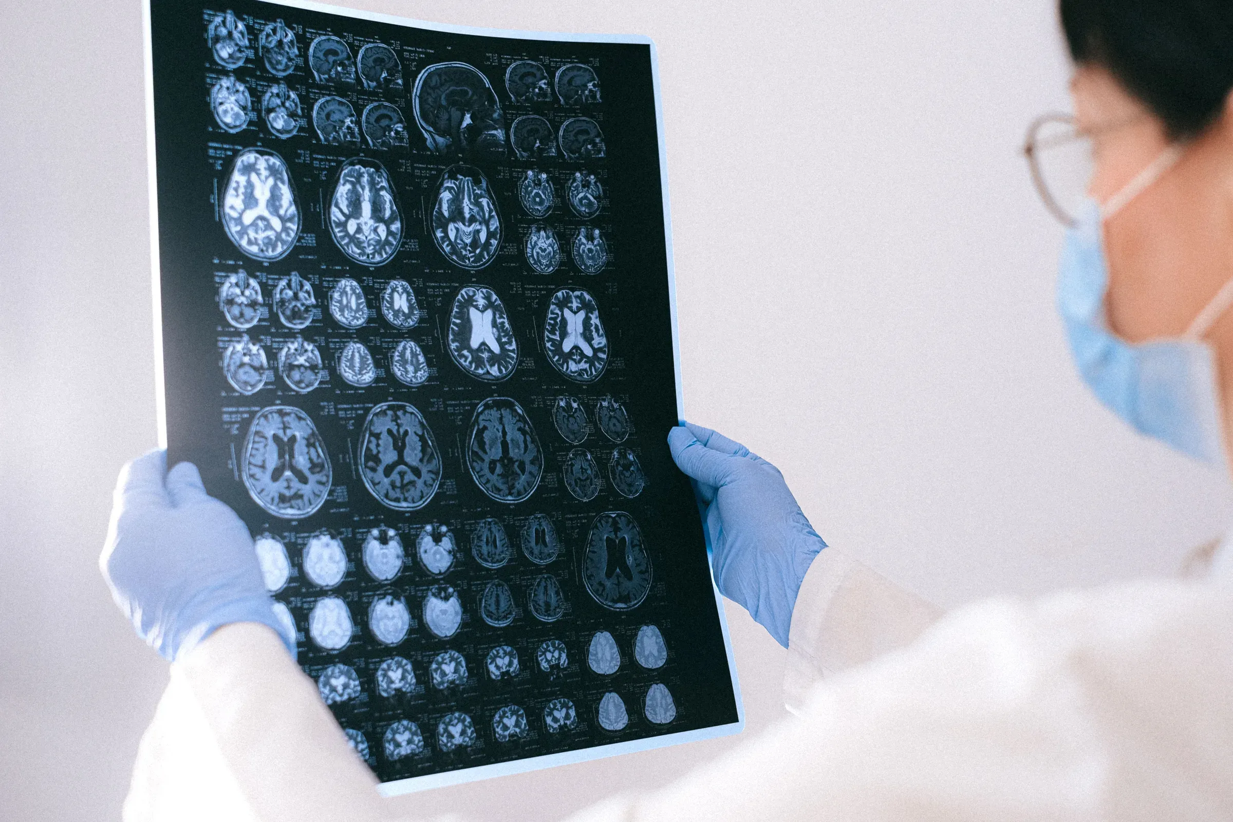 Medical professional reviewing a brain scan